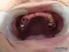 女性在yp后如何正确对待心理阴影？